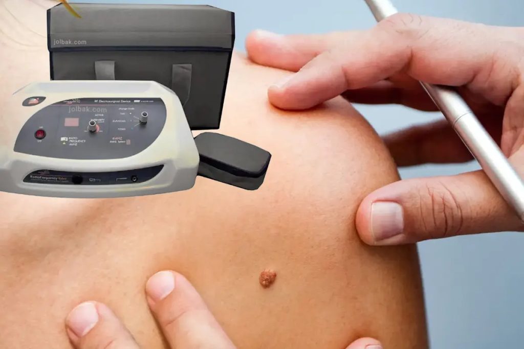 دستگاه آر اف سرجیکال