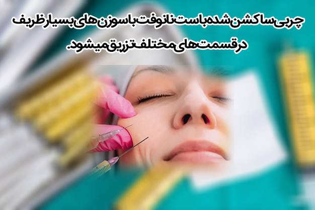 نانوفت لیپوریس