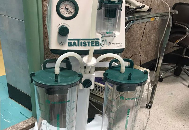 انواع دستگاه های لیپوساکشن